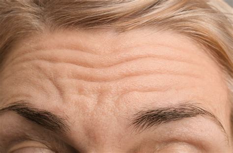 Arrugas PenalbaWeb.com