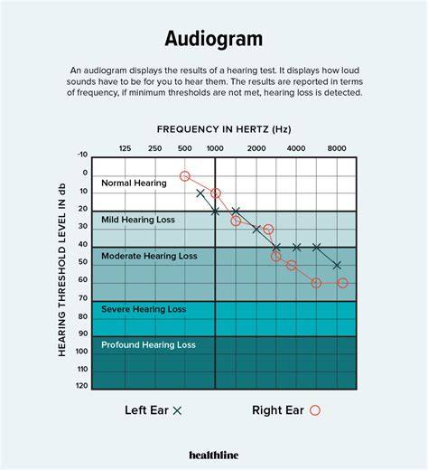 Audiogram PenalbaWeb.com