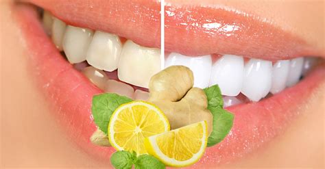 Blanquea dientes PenalbaWeb.com