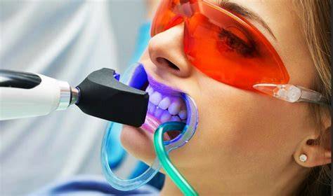 Blanqueamiento dental led PenalbaWeb.com