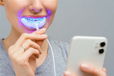 Blanquear dientes PenalbaWeb.com