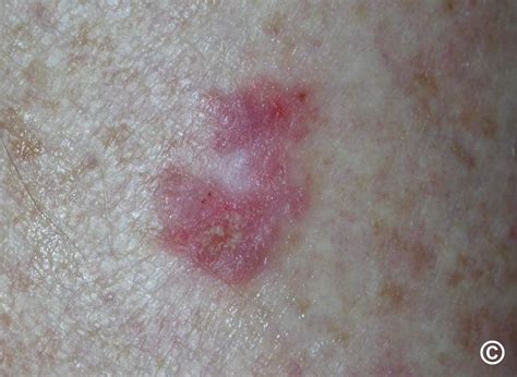 Bowens PenalbaWeb.com