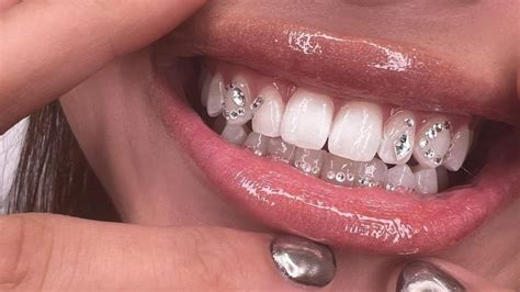 Brillantes para dientes PenalbaWeb.com