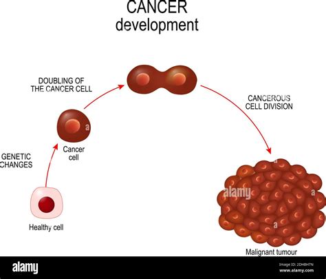 Cancer PenalbaWeb.com