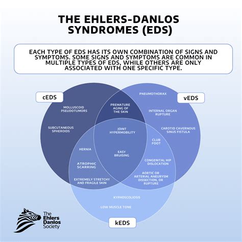 Classic eds PenalbaWeb.com