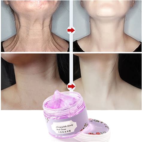Crema cuello PenalbaWeb.com