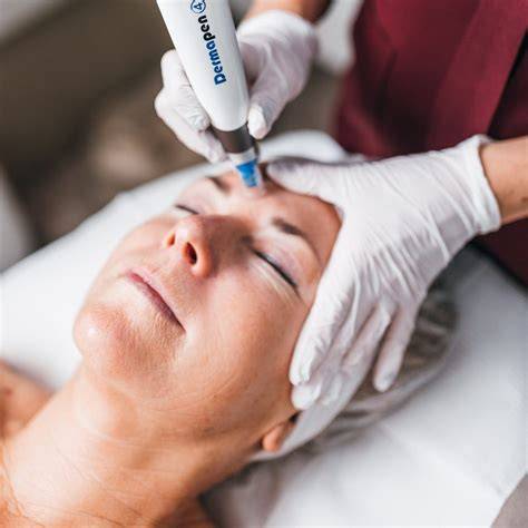 Dermapen PenalbaWeb.com