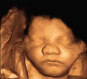 Eco 4d PenalbaWeb.com