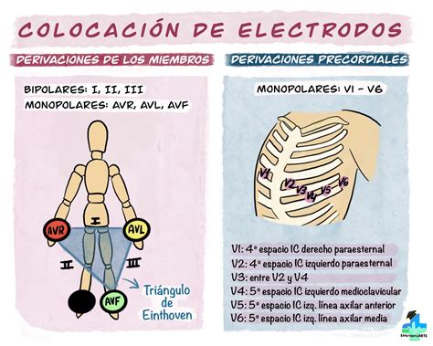 Electrodos PenalbaWeb.com
