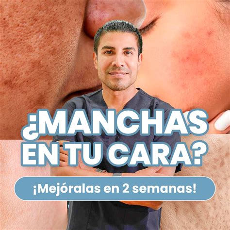Elimina manchas PenalbaWeb.com