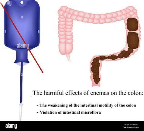 Enemas PenalbaWeb.com