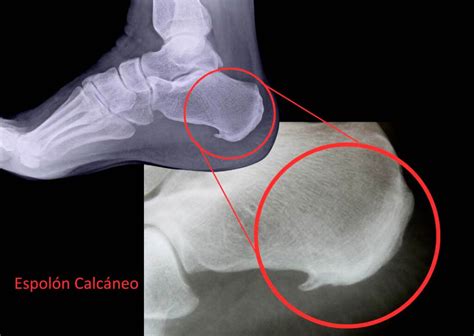 Espolon PenalbaWeb.com