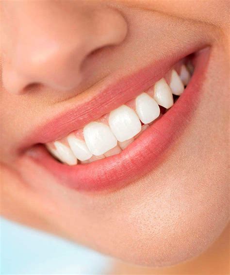 Estetica dental PenalbaWeb.com