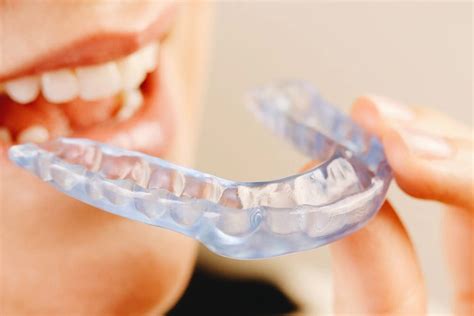 Ferula dental PenalbaWeb.com