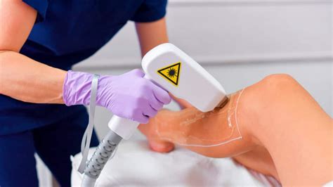 Fotodepilacion laser PenalbaWeb.com