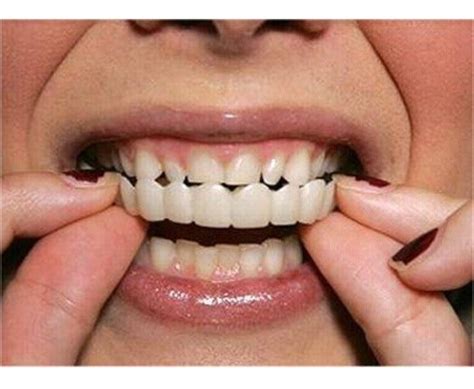 Fundas para dientes PenalbaWeb.com