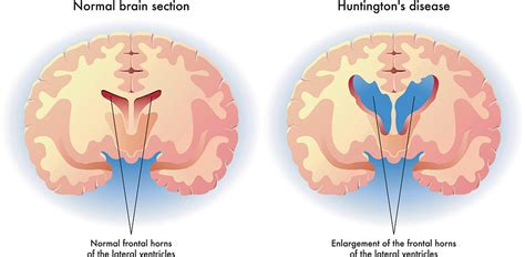 Huntington PenalbaWeb.com