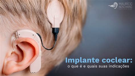 Implante coclear PenalbaWeb.com