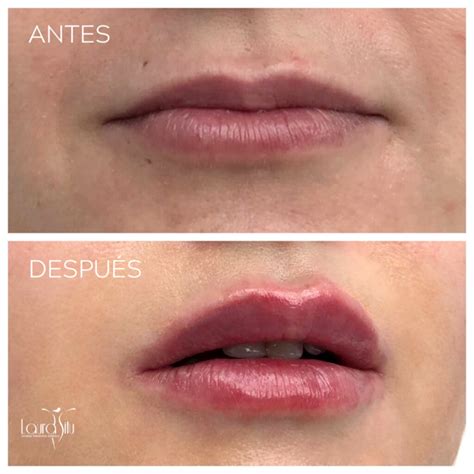 Labios barcelona PenalbaWeb.com