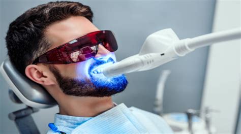 Lampara led blanqueamiento dental PenalbaWeb.com