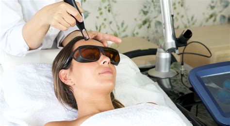 Laser manchas cara PenalbaWeb.com