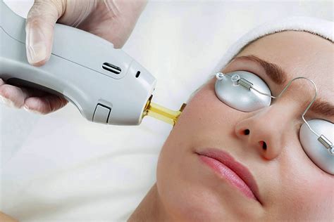 Laser nd yag PenalbaWeb.com