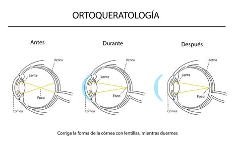 Lentes k PenalbaWeb.com