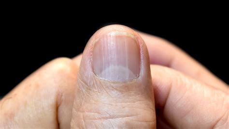 Lunula PenalbaWeb.com