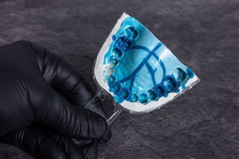 Material dental PenalbaWeb.com