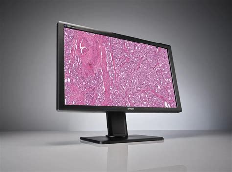 Monitor digital PenalbaWeb.com