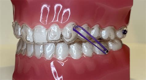 Ortho PenalbaWeb.com