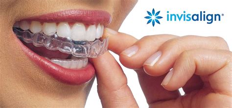 Ortodoncia invisalign PenalbaWeb.com