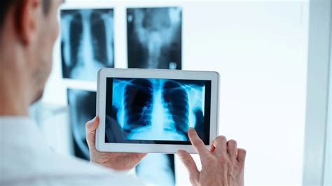 Radiografia PenalbaWeb.com