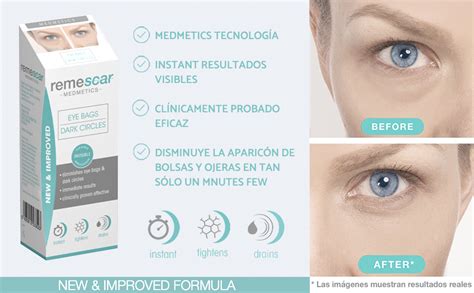 Remescar ojeras PenalbaWeb.com
