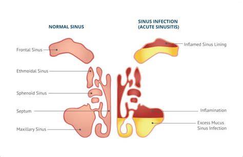 Sinus PenalbaWeb.com