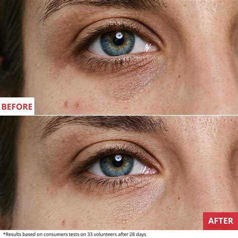 Skin therapy eye cream PenalbaWeb.com