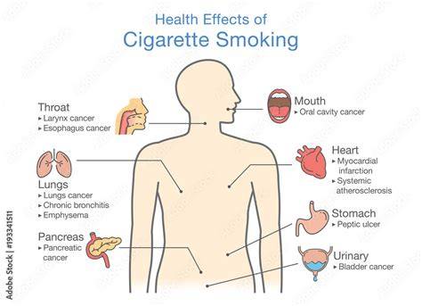 Smoking PenalbaWeb.com