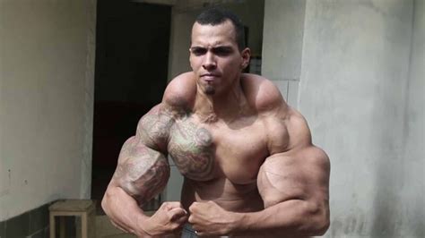 Synthol PenalbaWeb.com