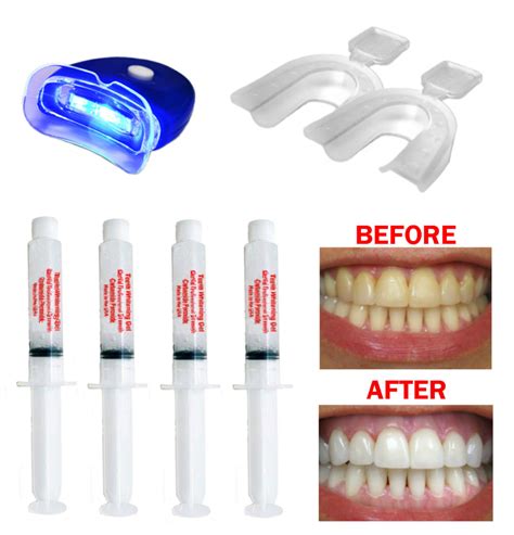 Teeth whitening PenalbaWeb.com