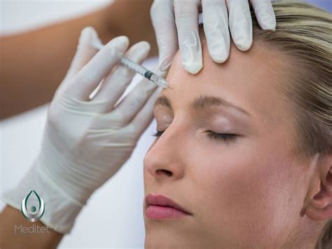 Tratamiento botox PenalbaWeb.com